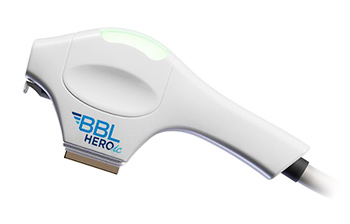 BBL HEROic омолодження шкіри зі штучним інтелектом BBL HEROic омолодження шкіри зі штучним інтелектом